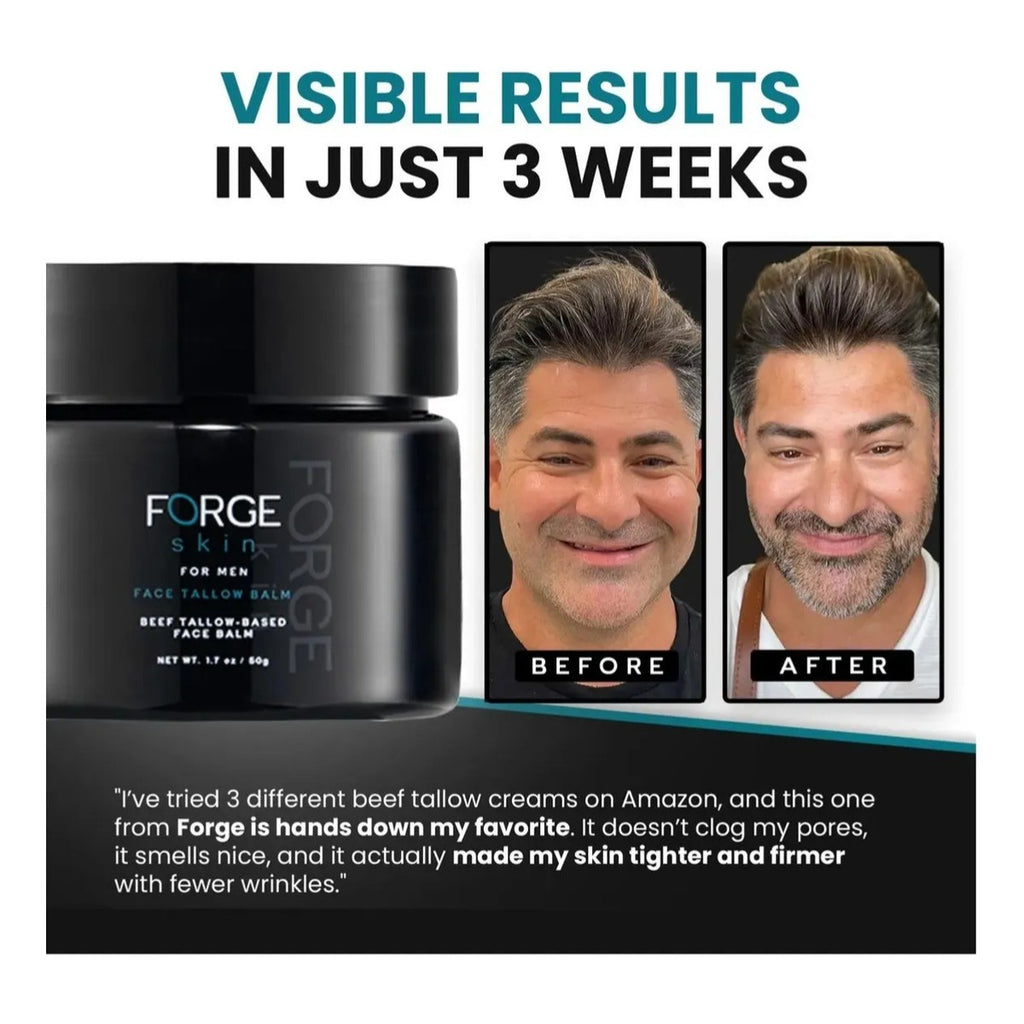 Forge Skin Bálsamo Sebo Res 50ml Hidratante Original Pack 2