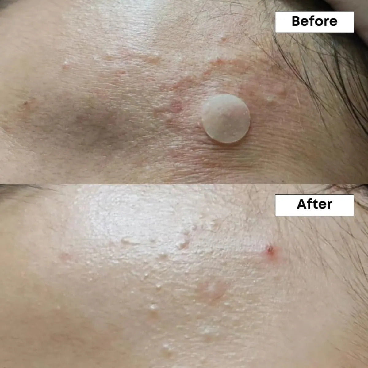 Nineless Serum Facial Piel Grasa Anti Imperfecciones 30ml